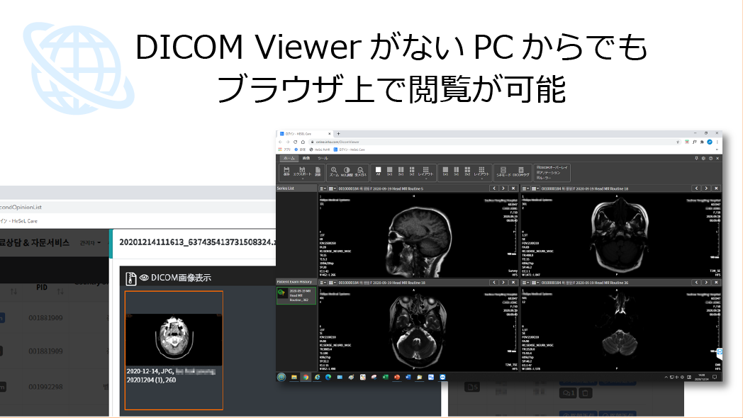 WebブラウザでDICOM画像の表示が可能