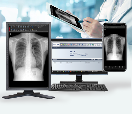 「HESEL MD」は、患者が持参した他病院の検査データ(CD/DVD)をPACS Serverへ転送、または、X-rey(レントゲン)、CT、MRI、CR、PET、RI、アンギオ、超音波、内視鏡等のDICOMデータなどの医用検査データをCD/DVDに書き出し可能。JPEGをDICOM変換、DICOM Q/R、患者ID変更や匿名化機能を基本搭載している。